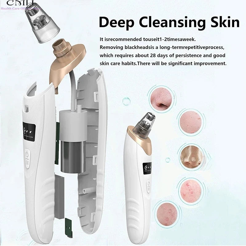 Blackhead Remover Vacuum Pore Cleaner