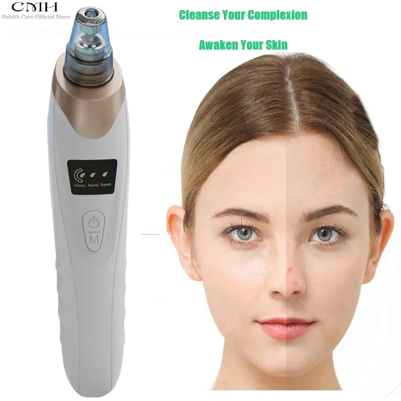 Blackhead Remover Vacuum Pore Cleaner